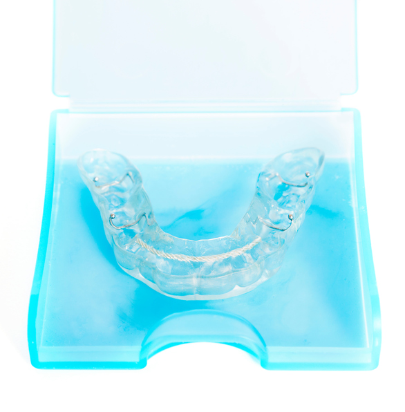 Image of a mouthguard