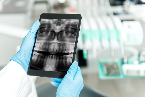 Image of digital x-rays at Premier Dental.