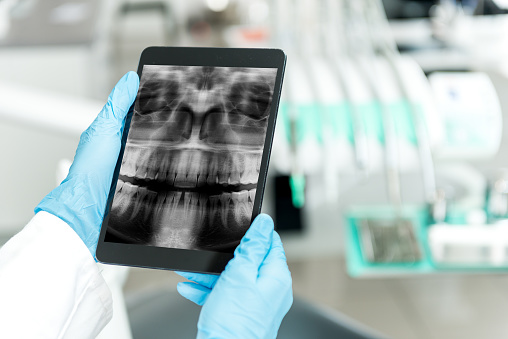 Image of digital x-rays at Premier Dental Center.