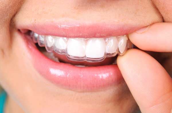 Woman using clear aligners at Premier Dental Center.