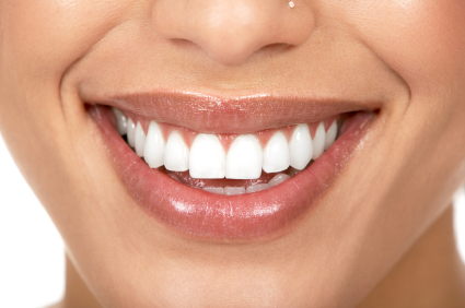 Close up of a woman's mouth after veneer treatment at Premier Dental Center in Jackson, TN 