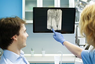 Why Do You Need Dental X-Rays?